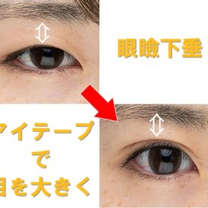 眼瞼下垂を自力で治したい 自分で治すのは困難
