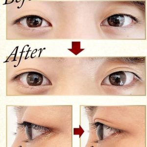 伸びた瞼を二重にする方法 9つ 二重にならない方 必見