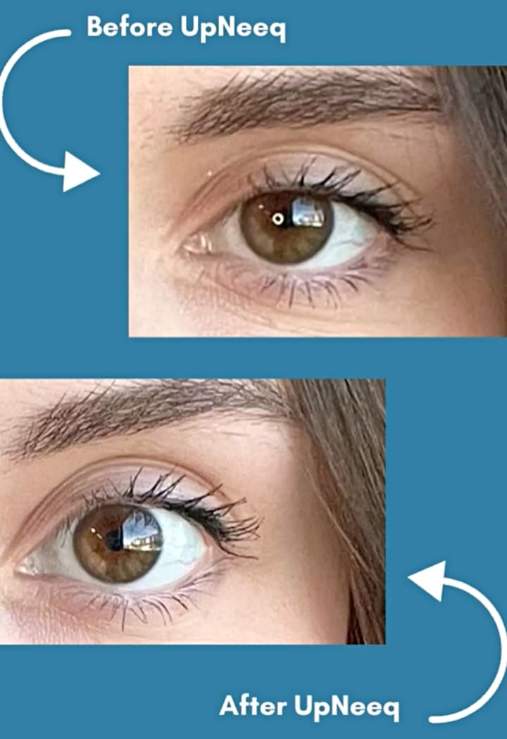 目薬 眼瞼下垂治療薬 効果